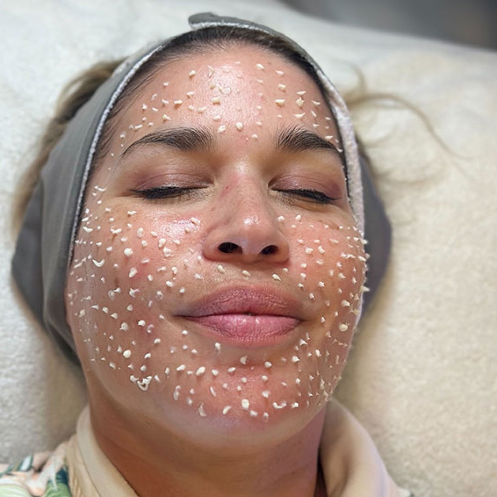 microspear behandeling in kliniek